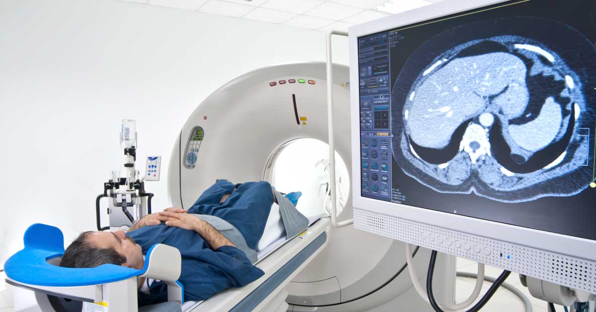 What are the side effects of an MRI?