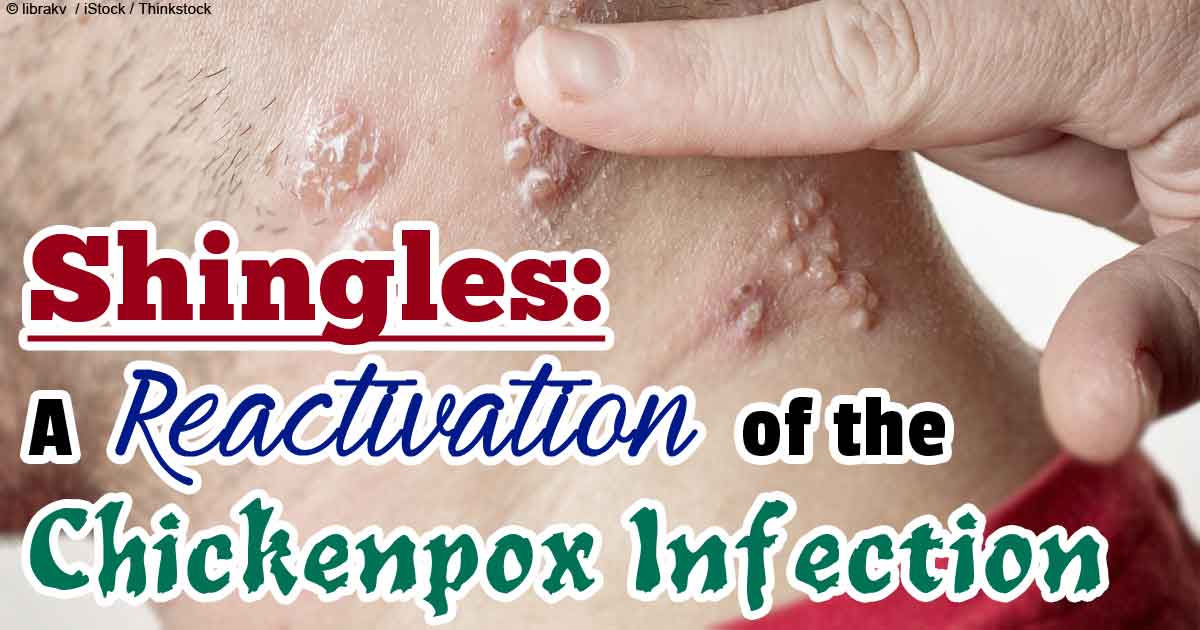Is shingles contagious for adults?