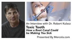 Toxic Tooth—How a Root Canal Could Be Making You Sick