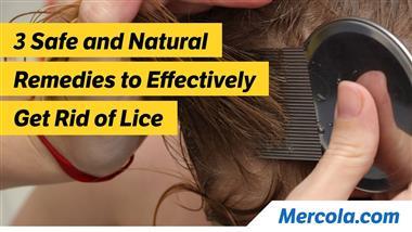 How to Get Rid of Lice
