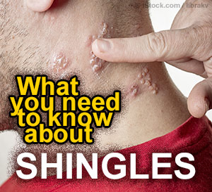 facts about shingles