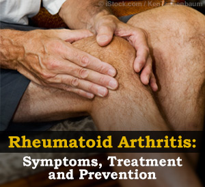 rheumatoid arthritis protocol