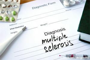 Esclerosis Multiple