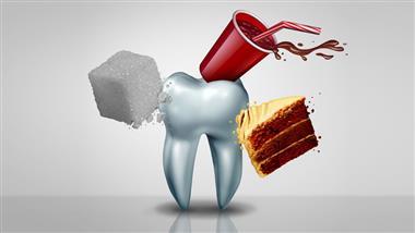 teeth whitening or soda damages your teeth