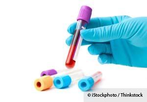 What do ferritin levels in a blood test measure?