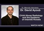 Epidemic of Infantile Rickets May Have Put Thousands of Innocent Parents in Jail for Child Abuse