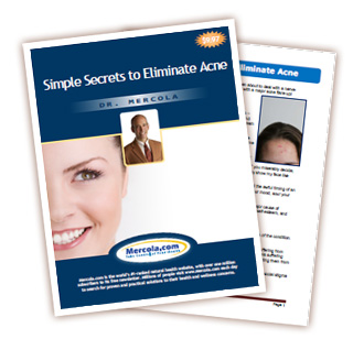 How to Get Rid of Acne Free Report