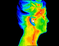 Infrared Thermography