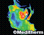 Thermography Detect Sinus