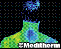 Thermography Scan