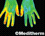 Infrared Thermography