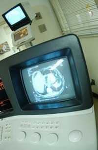 CT scans, radiation, FDA