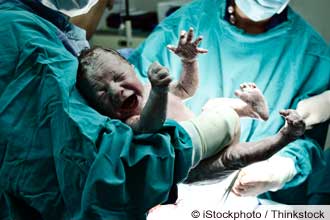 umbilical cord