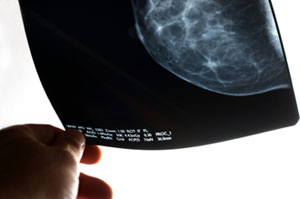 cancer doctor analyzing mammogram