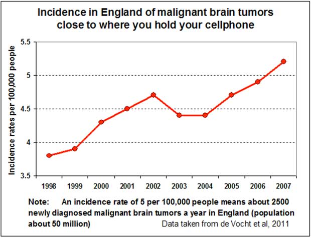 England Study on Brain Tumors