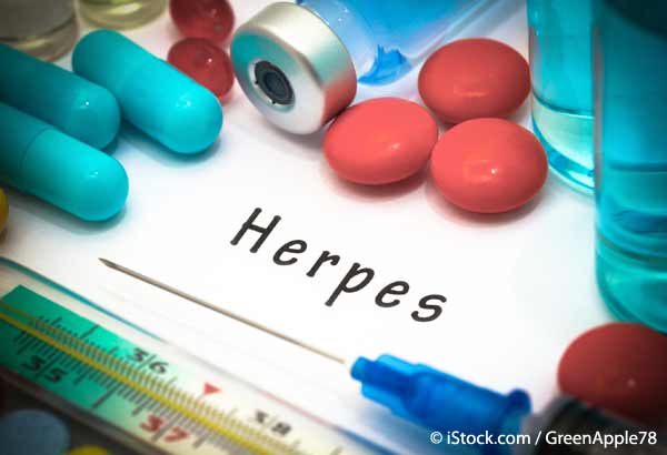 herpes treatment remedies