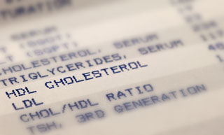 The Cholesterol Myth That Is Harming Your Health