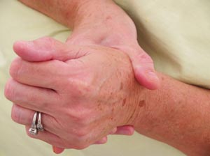 Arthritis Patients Benefit from Weight Training