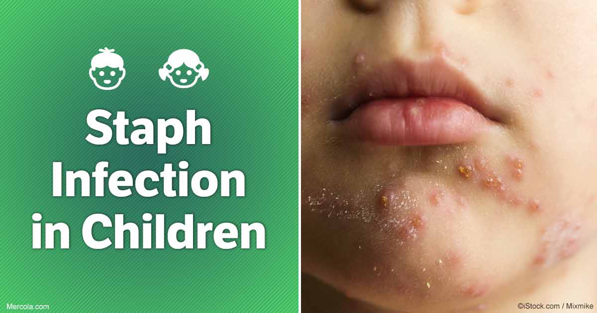 Staph Infections in Children