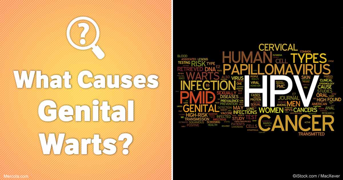 What Causes Genital Warts