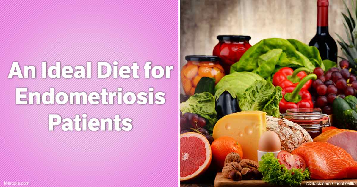 An Ideal Diet for Endometriosis Patients