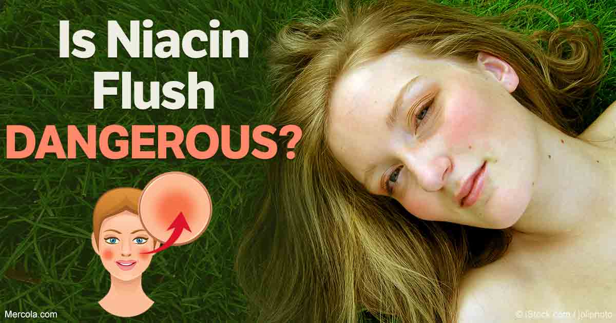 why niacin causes flushing