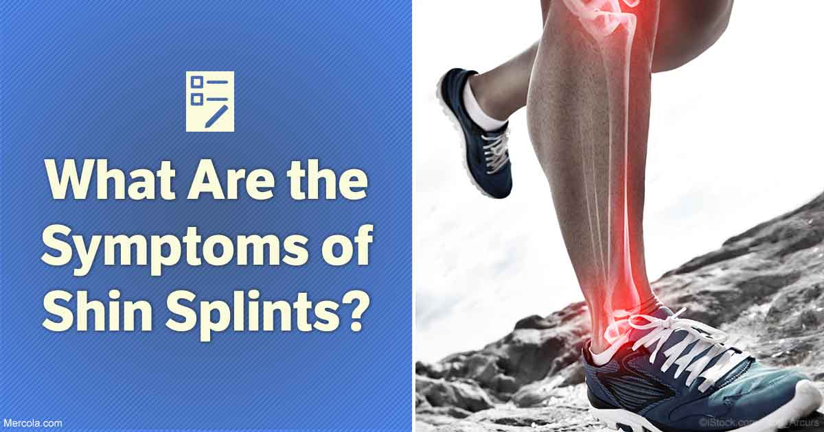 What Are the Symptoms of Shin Splints?