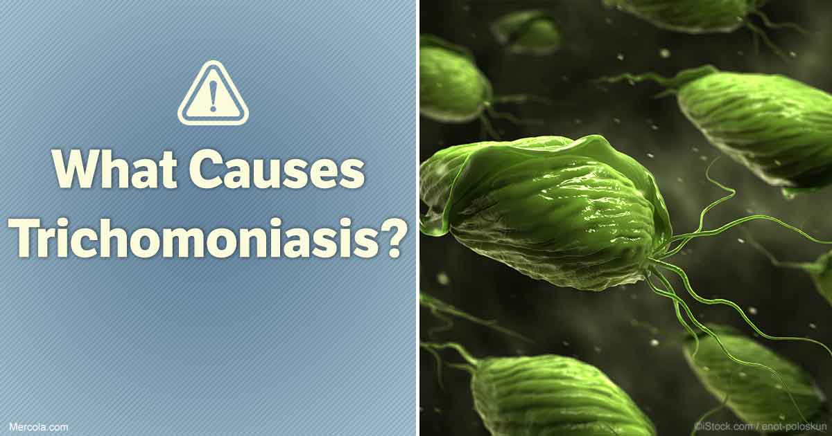 What Causes Trichomoniasis?