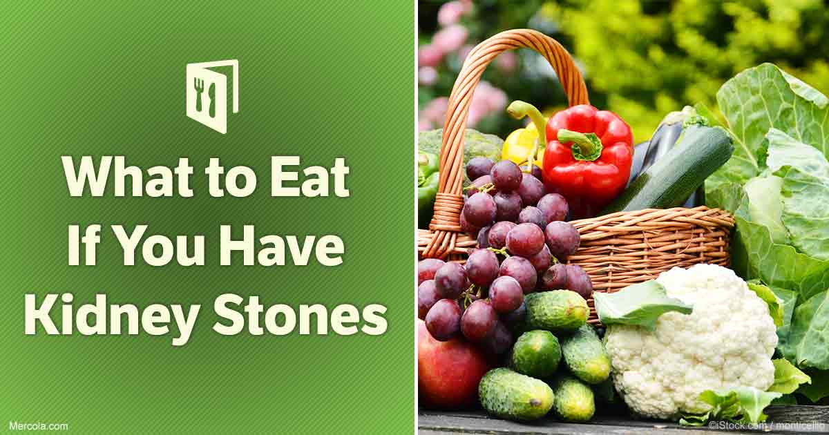 uric acid foods to avoid for kidney stones