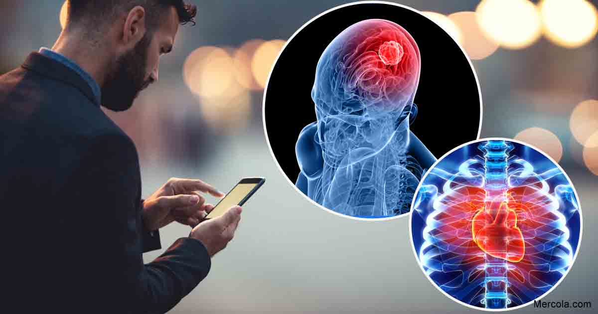 Reproduced Government Study Shows Cellphones Linked to Tumors