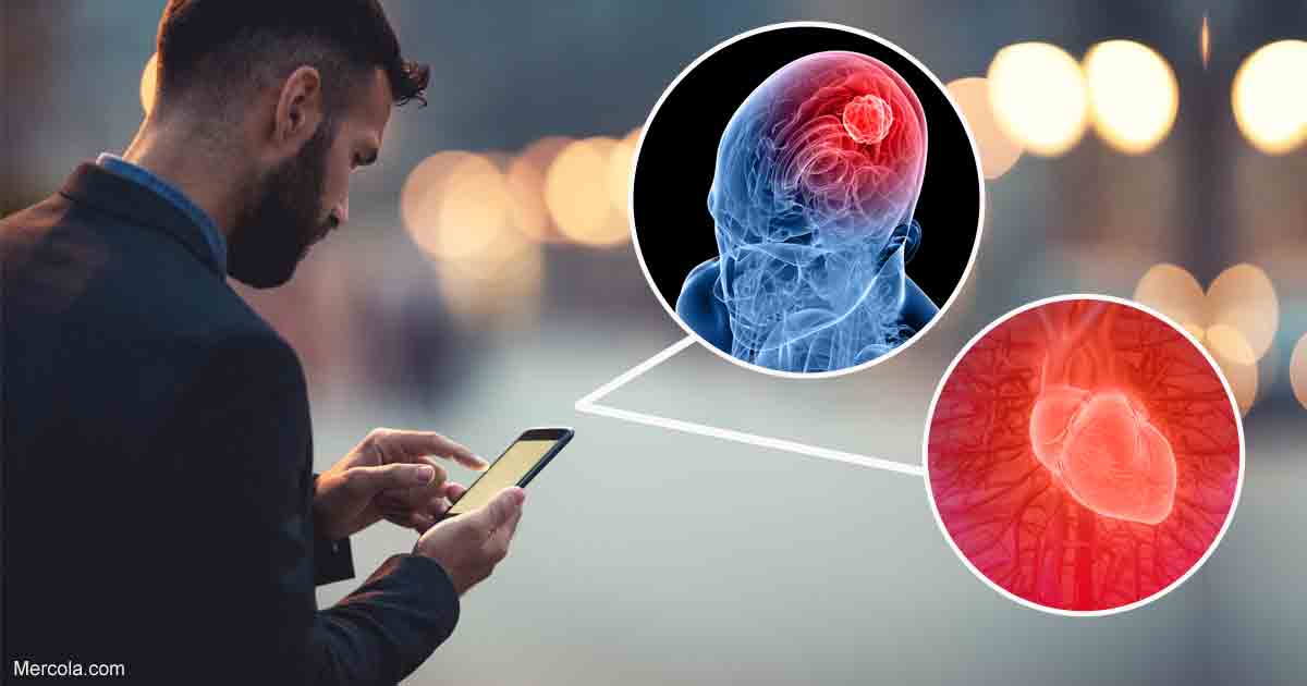 Study Links Cellphone Radiation to Heart and Brain Tumors