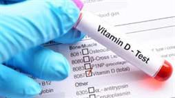 prueba de vitamina d