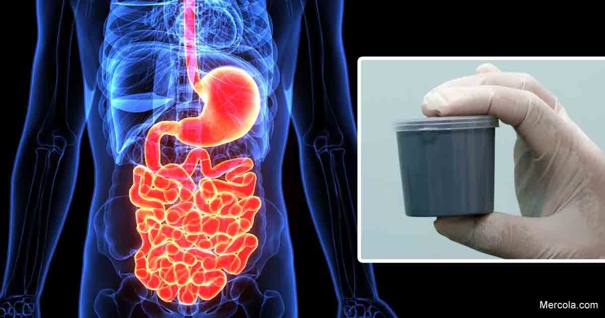 Super Poopers: Premium Donors Sought for Fecal Transplants