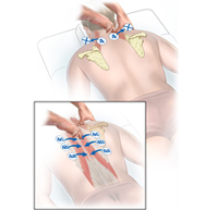 Thoracic spine PRI-moves