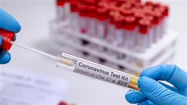 prueba de coronavirus