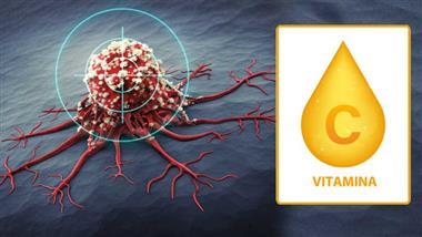 vitamina c mejora tratamiento de cancer