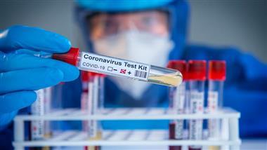 test de coronavirus