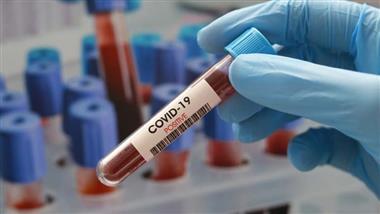 Su grupo sanguíneo podría influir en su riesgo de COVID-19
