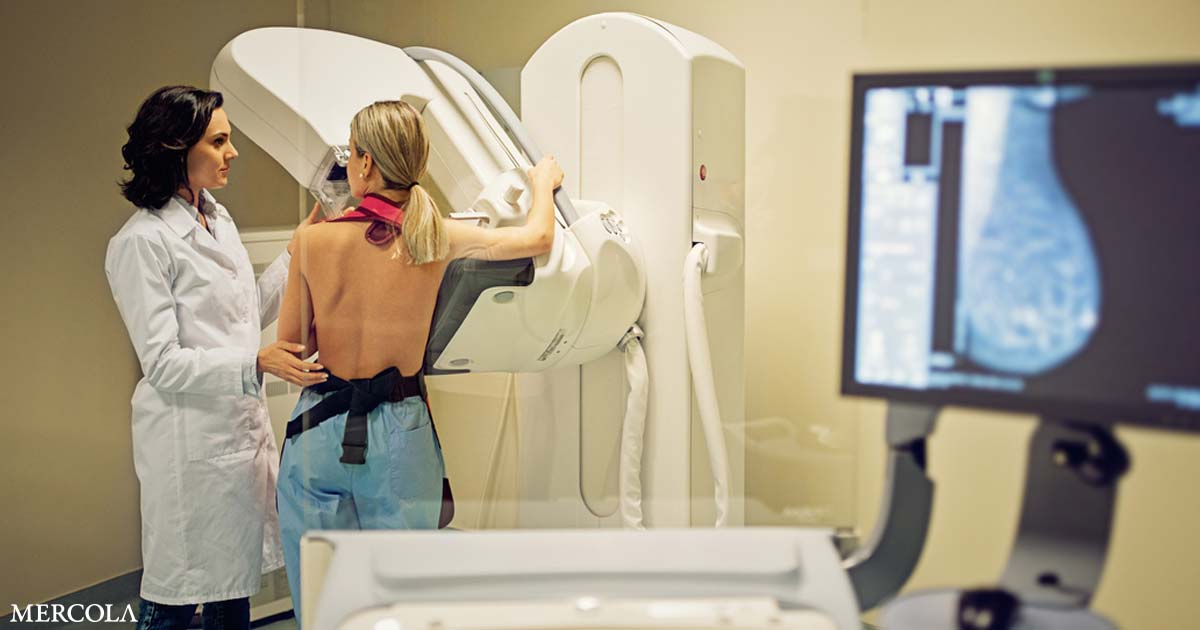 50% of Women Had a False-Positive Mammogram After 10 Years