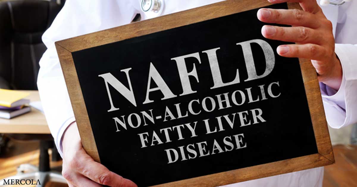 Can B Vitamins Help Prevent Nonalcoholic Fatty Liver Disease?