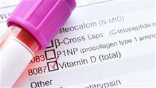 New Study on Vitamin D Combating COVID