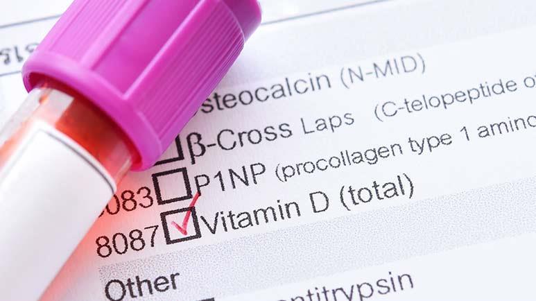 Neue Studie über Vitamin D zur Bekämpfung von COVID