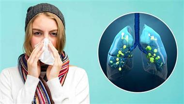 Muertes por la gripe son en realidad por infecciones secundarias