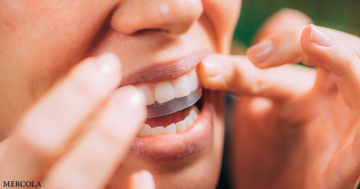 Whitening Strips or Soda? Which Is Worse for Your Teeth?