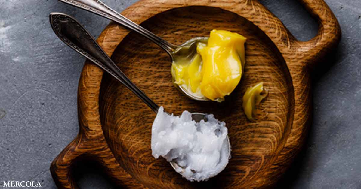Why Butter and Coconut Oil Are Good for You