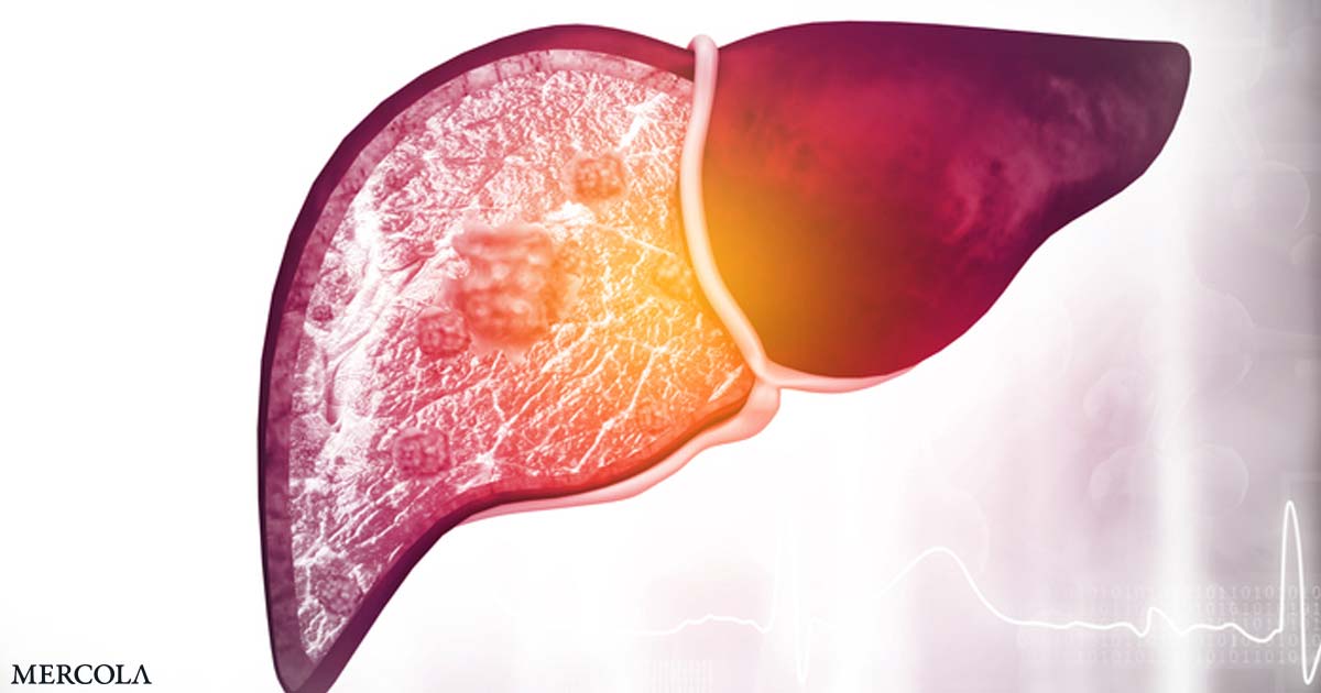 Understanding Your Liver Health