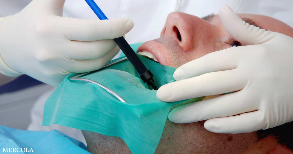 If Your Dentist Recommends This, Consider a New Dentist