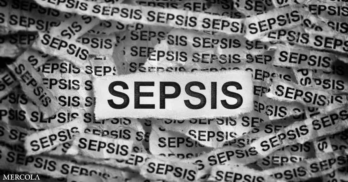 Sepsis May Be Responsible for 20% of Deaths Worldwide
