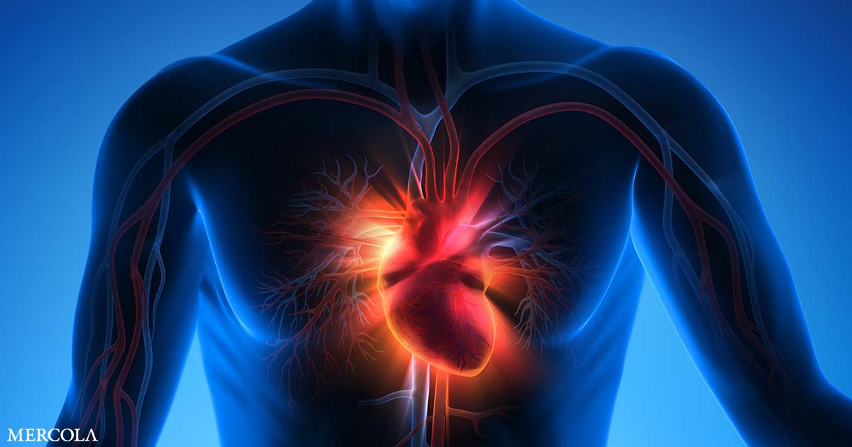 Do Heart Attack Symptoms Vary Between Men and Women?