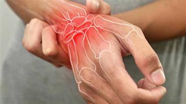 rheumatoid arthritis immune aging